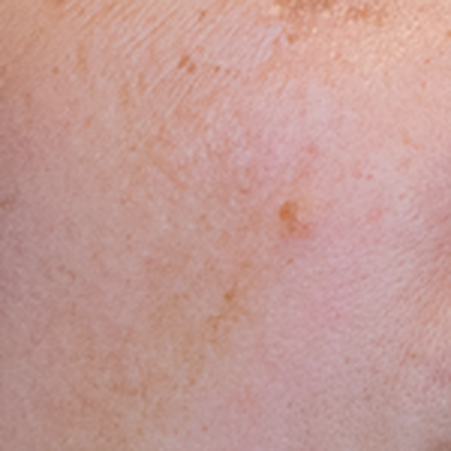 Nicole Reincke Kosmetik – Kosmetikbehandlung – Aqua Facial